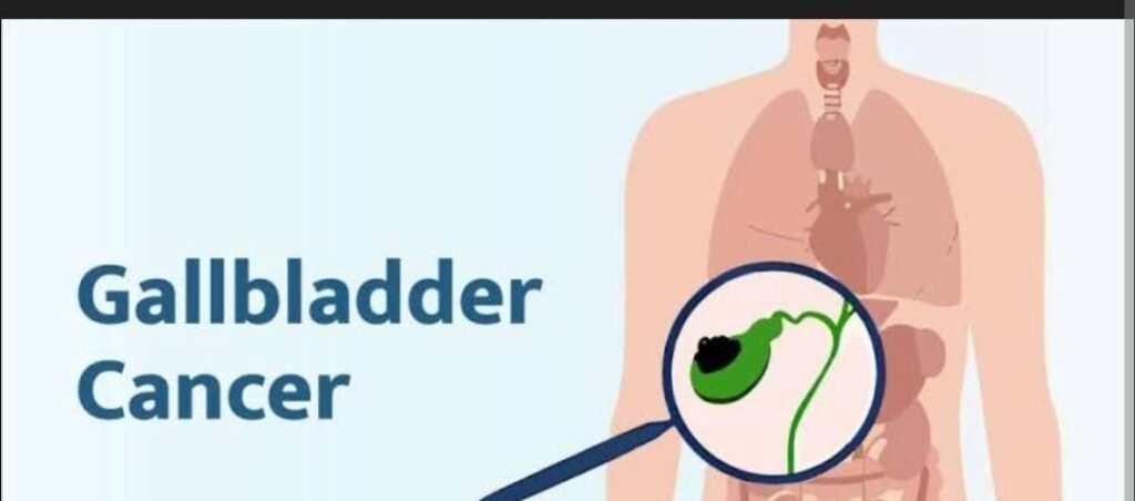 5 unusual symptoms of Gallbladder cancer 

1. Persistent, unexplained itchy skin.

2. Dark urine and pale stoo