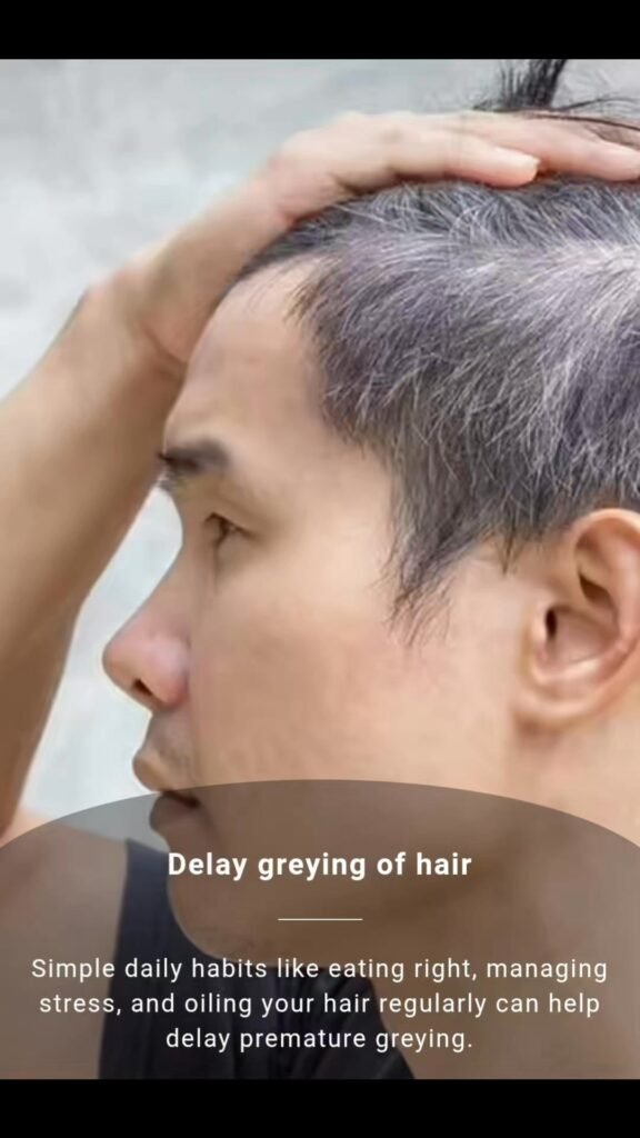 Daily Habits That Can Delay Greying Of Hair