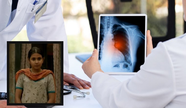 What is Dermatomyositis - the rare autoimmune disease that claimed 'Dangal' actor Suhani Bhatnagar's life