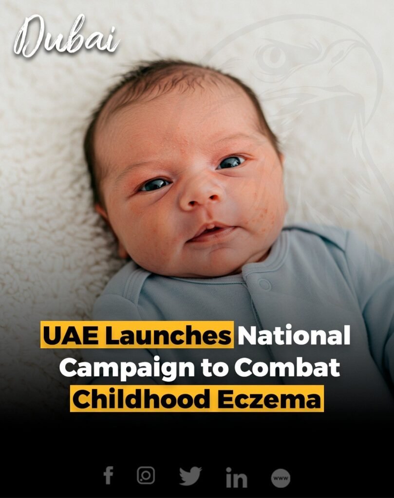 The UAE has launched ECZPLORE, a nationwide campaign to raise awareness and improve care for children with ecz