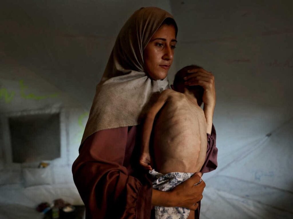 URGENT: Gaza Death Toll from Starvation Rises to 133

The humanitarian crisis in Gaza deepens as the number o