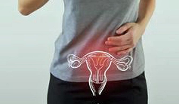 Cervical cancer: What you need to know