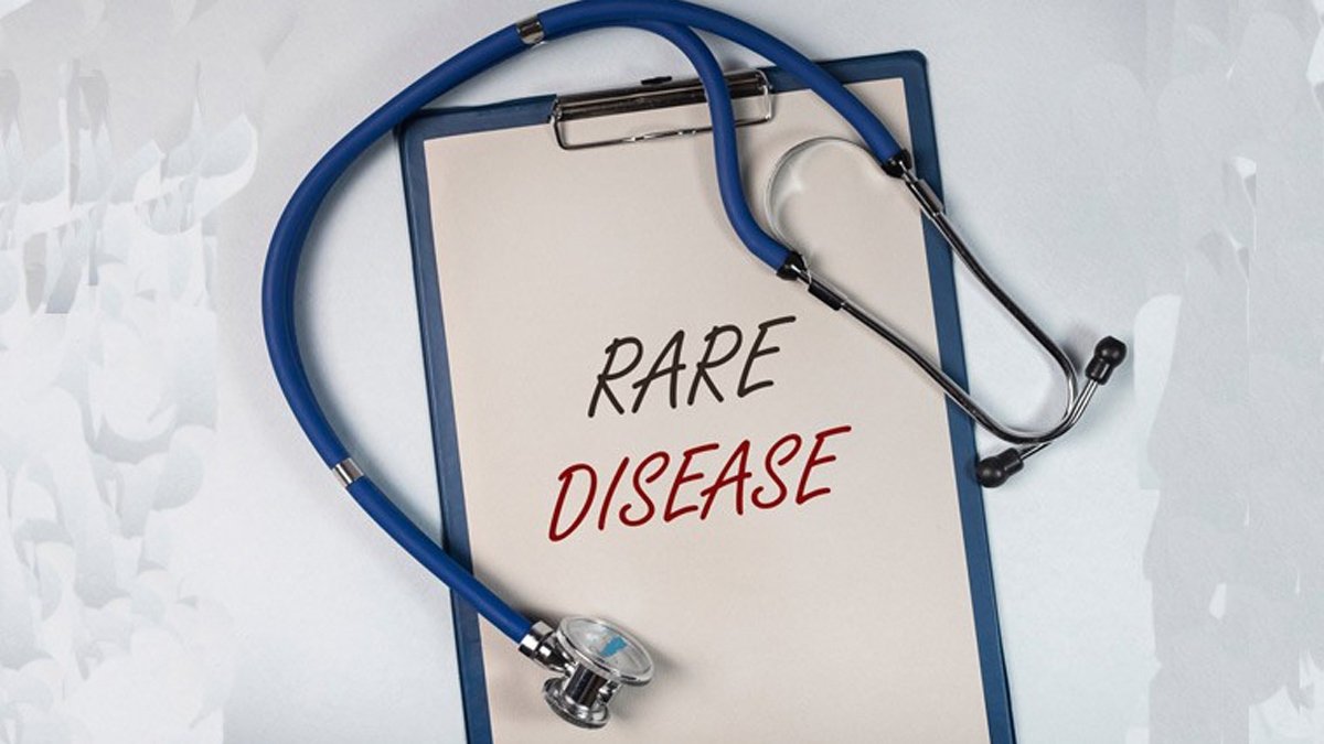 Guillain-Barré Syndrome death in Maharashtra: What to know about rare immunological nerve disorder GBS